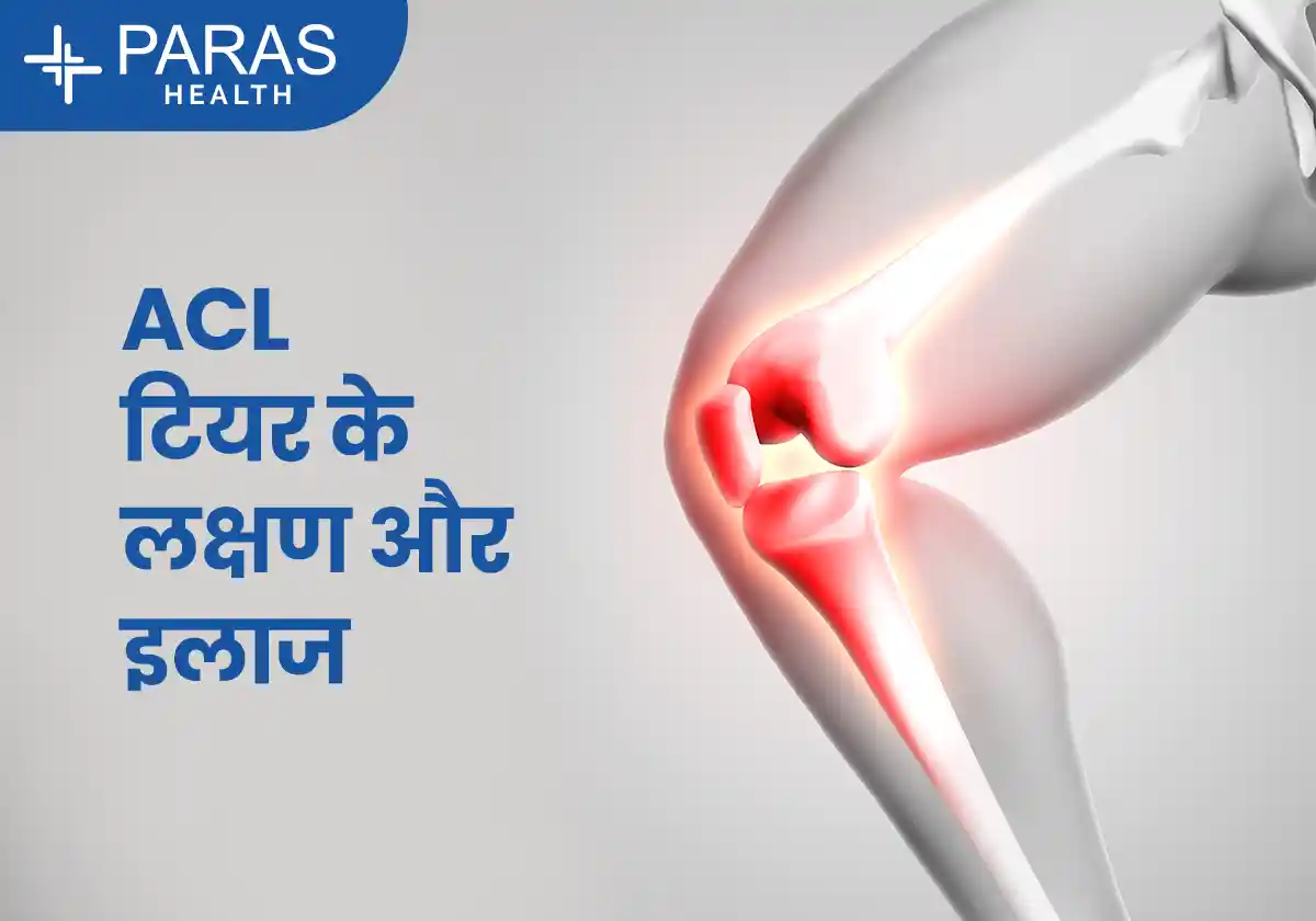 ACL टियर क्या है? लक्षण, कारण, और इलाज